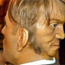 ये है दुनिया का पहला दो चेहरे वाला इंसान, सच्चाई जानकर रूह काँप जाएगी