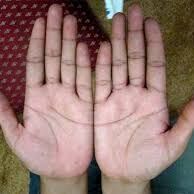 अगर आपकी हथेली पर भी है ये निशान, तो कम उम्र में आपको अमीर बनने से कोई नहीं रोक सकता