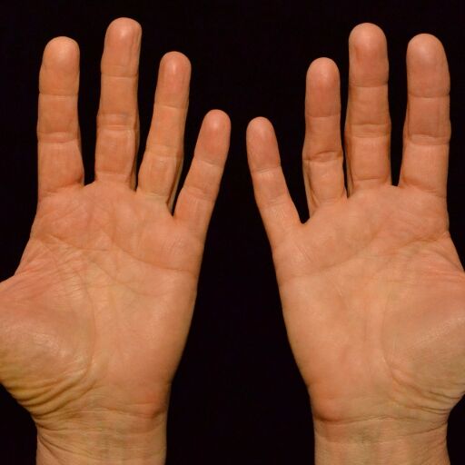 हथेली बताती है किस रोग से हो सकते हैं परेशान