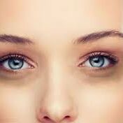 आँखों के नीचे डार्क सर्कल, इस कारण होते हैं, जानिए... आँखों के नीचे डार्क सर्कल, इस कारण होते हैं, जानिए...