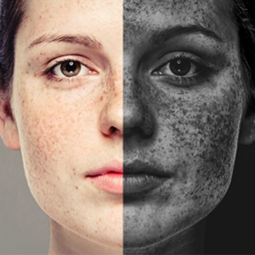 त्वचा और बालों को प्रदूषण कैसे बचाए, जानिए कुछ उपाय...