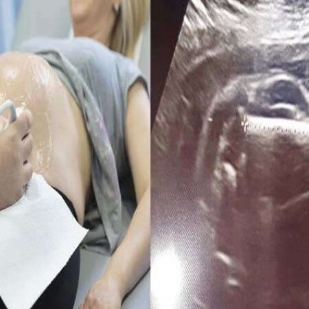 इस महिला के पेट में बच्चा नहीं बल्कि पल रही थी स्पोर्ट्स कार