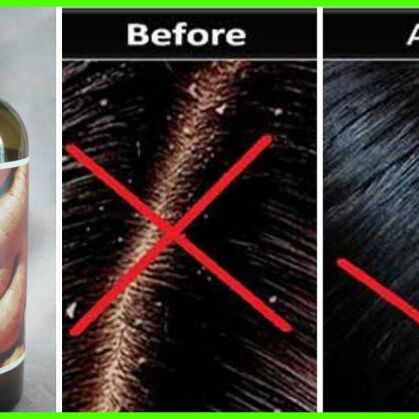 ये हैं 5 बेस्ट हर्बल शैम्पू जो आपके बालों को रखेंगे हमेशा डैंड्रफ से दूर