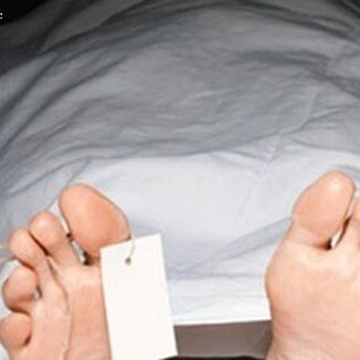 बड़नगर में जिंदा गर्भवती को डाल दिया पोस्टमार्टम रूम में