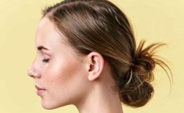 उम्र बढ़ने के साथ चेहरे स्किन होती है लूज़ तो अपनाएं ये टिप्स