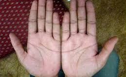 अगर आपकी हथेली पर भी है ये निशान, तो कम उम्र में आपको अमीर बनने से कोई नहीं रोक सकता