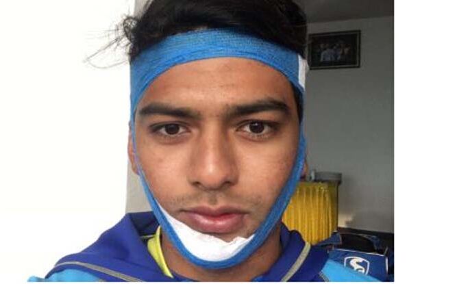 इस खिलाड़ी ने टूटे जबड़े के साथ ठोंका विजयी शतक, दोहराया कुंबले का कमाल