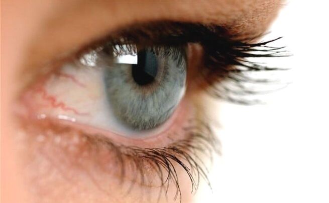 कॉन्टेक्ट लेंस पहनने वालों के लिए खतरा, संक्रमण से हो सकता है अंधापन