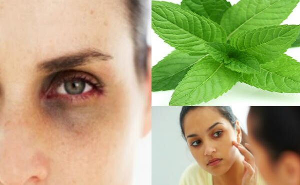 डार्क सर्कल, डेड स्किन और झाईयों से छुटकारा दिलाते हैं पुदीने के पत्ते