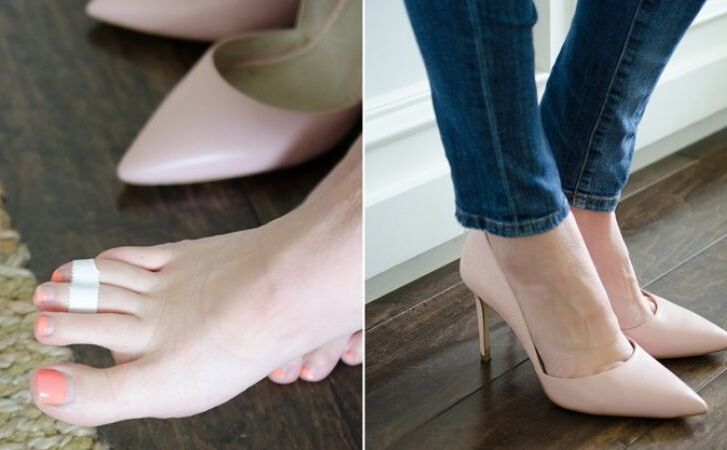नए जूतों की चोट से ऐसे बचाएँ अपने पैरों को