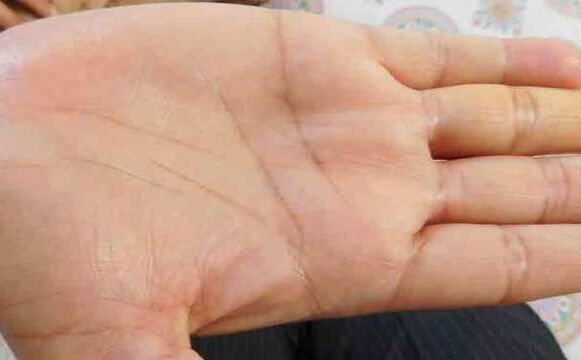 आपकी हथेली का रंग बताएगा आपका हाल